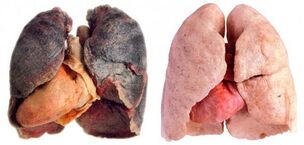 the smoker's lungs are healthy